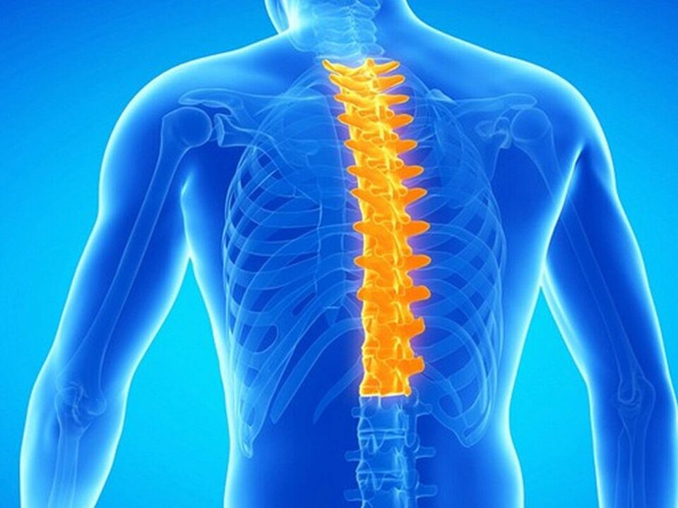 Lesione della colonna vertebrale toracica nell'osteocondrosi