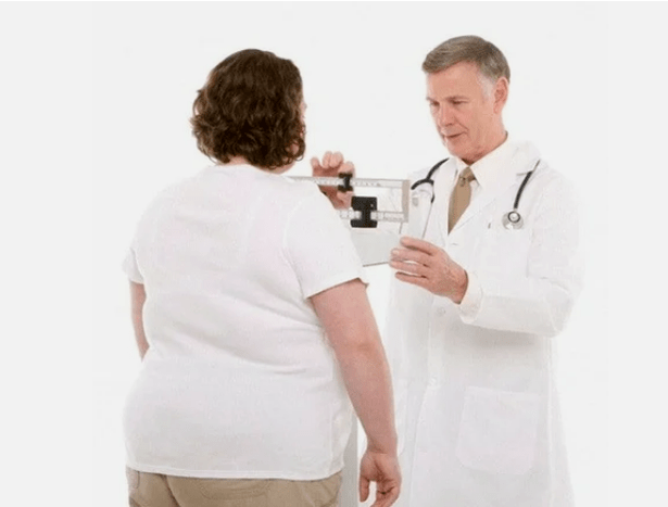 L’obesità è una causa di osteoartrite
