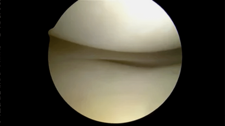 Visione astroscopica di superfici perfettamente sane