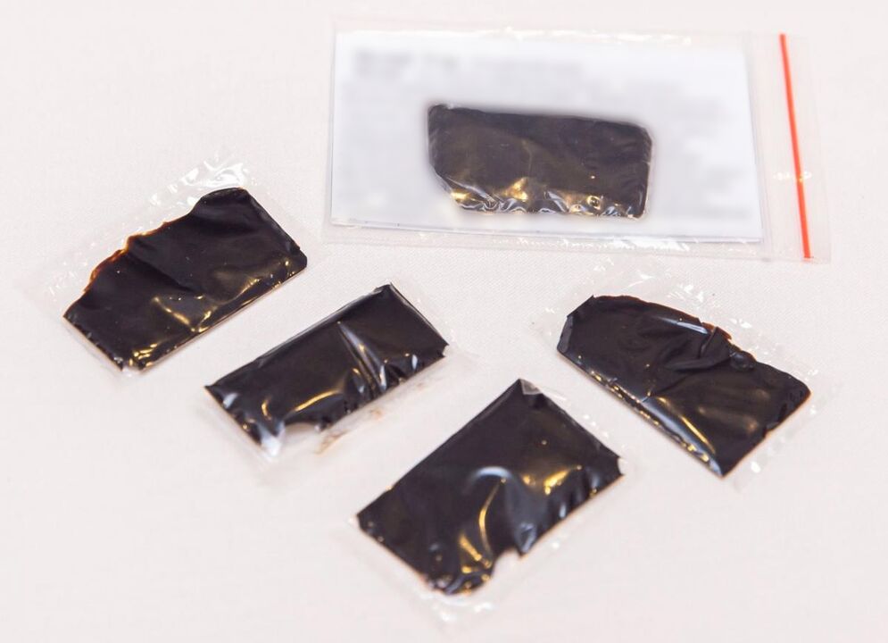 Shilajit è un rimedio efficace per il trattamento dell'osteocondrosi cervicale a casa