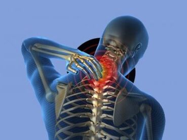 Una persona con osteocondrosi della colonna cervicale avverte dolore al collo